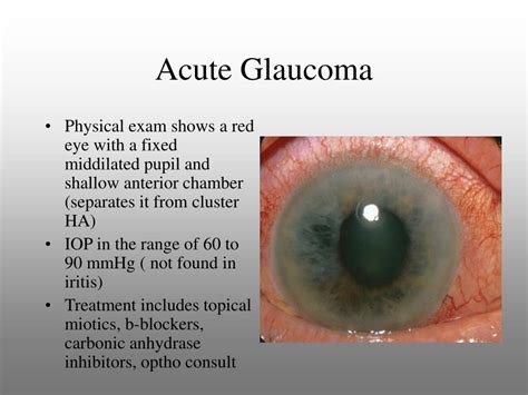 glaucoma test machine|glaucoma physical exam findings.